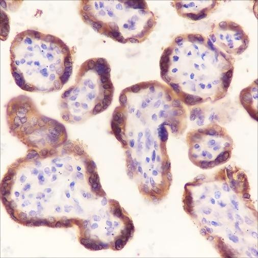 Anti-Recombinant Laminin beta 1, clone A284