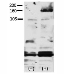 Anti-phospho-HER4/ERBB4 (Tyr1188)