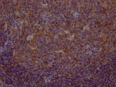 Anti-METAP2 Recombinant Monoclonal, clone 8F2