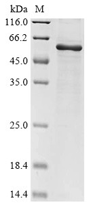 Glycoprotein (G), partial, Rabies virus, recombinant