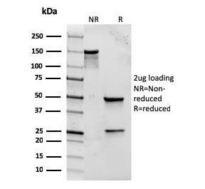 Anti-TLR2, clone rTLR2/221