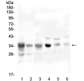 Anti-SFRP1