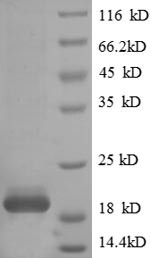 T cell receptor alpha constant (TRAC), human, recombinant