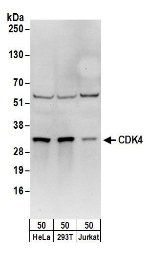 Anti-CDK4