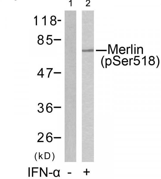 Anti-phospho-Merlin (Ser518)