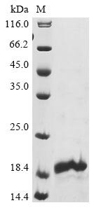 Neuron navigator 1 (NAV1), partial, human, recombinant