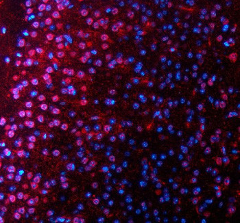 Anti-SALL2 / Spalt-like transcription factor 2