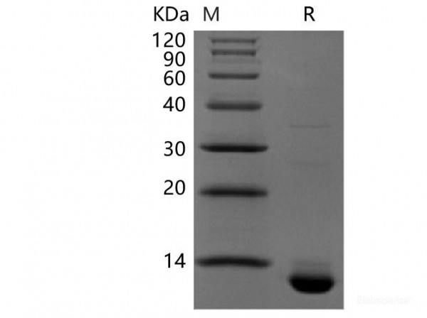 CLDN18.2(N-6His,C-Avi) (recombinant human)