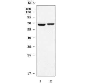 Anti-GPR50 / Melatonin-related receptor