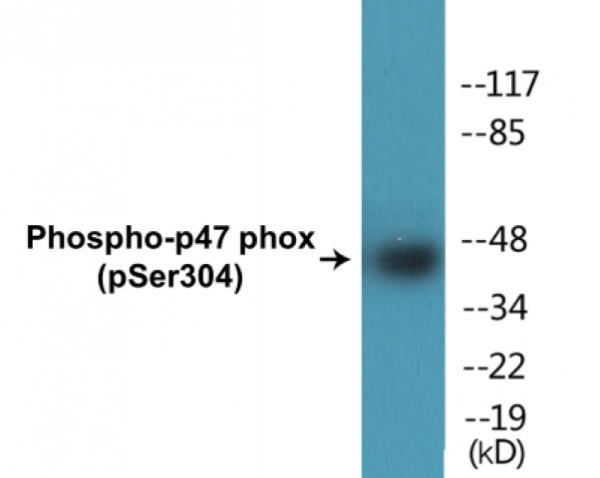 p47 phox (Phospho-Ser304) Colorimetric Cell-Based ELISA Kit