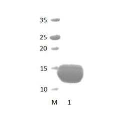 NHERF_2 PDZ Domain