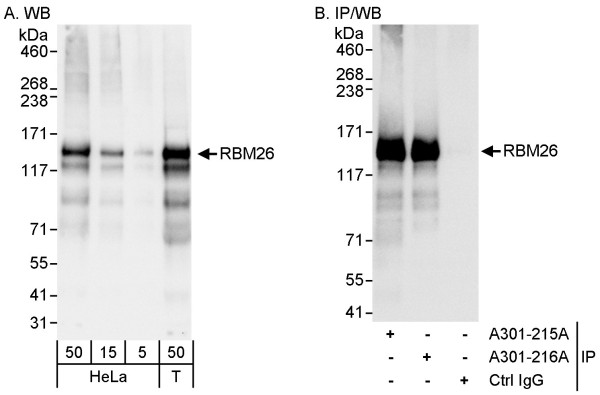 Anti-RBM26