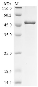 Ataxin-7-like protein 3 (ATXN7L3), human, recombinant