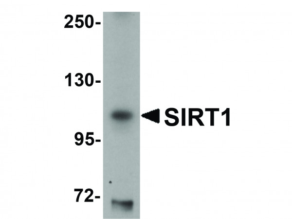 Anti-SIRT1