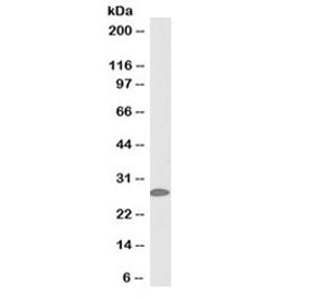 Anti-14-3-3 sigma (Biotin Conjugate)