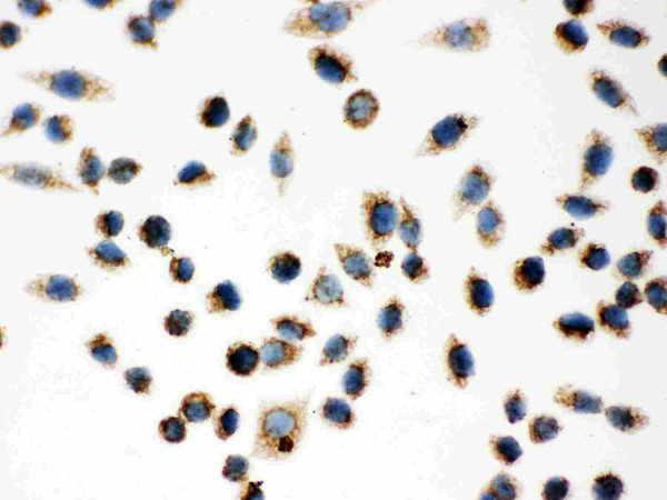 Anti-Hsp 60