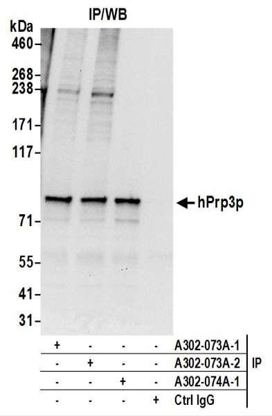 Anti-hPrp3p