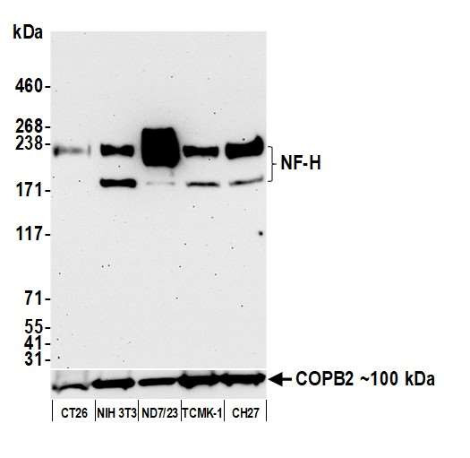 Anti-NF-H Recombinant Monoclonal