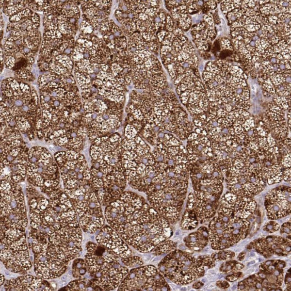 Anti-LIMS1