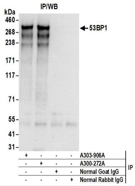 Anti-53BP1