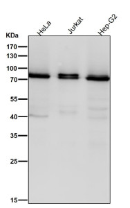 Anti-Pan-PKC / PRKCA/PRKCB/PRKCZ, clone 32P76