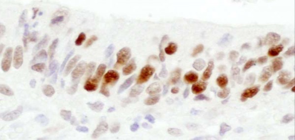 Anti-RCH1/KPNA2 (IHC)