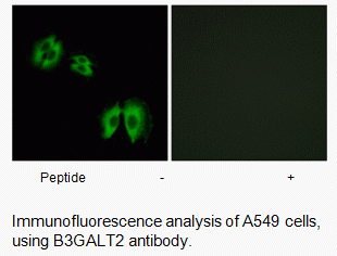 Anti-B3GALT2