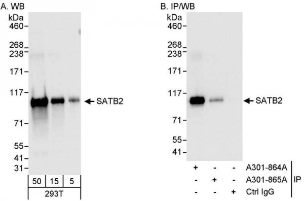 Anti-SATB2