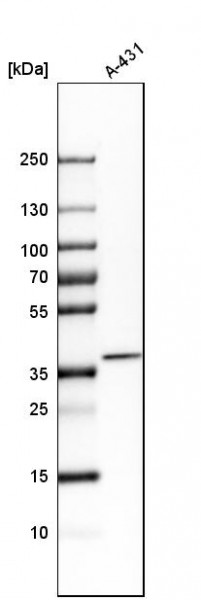 Anti-CDCA3