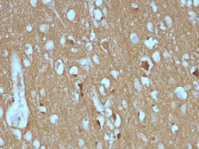 Anti-CD56 / NCAM1 (Neuronal Cell Marker)(Clone: SPM128)