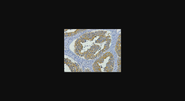 Anti-CK19, monoclonal