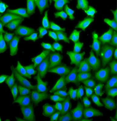 Anti-KLKB1 / Plasma Kallikrein