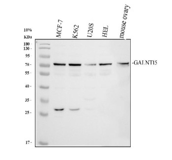Anti-GALNT15 / Polypeptide N-acetylgalactosaminyltransferase 15