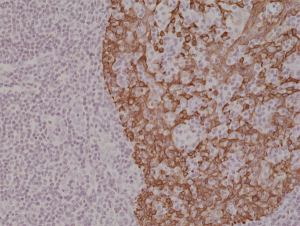 Anti-Cytokeratin-14 (human), Rabbit Monoclonal (RM328)