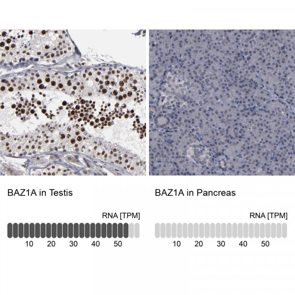 Anti-BAZ1A