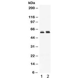 Anti-TCP1 epsilon / CCT5