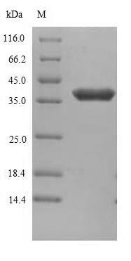 Anthrax toxin receptor 1 (ANTXR1), partial, human, recombinant