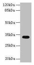 Anti-CYB5R2