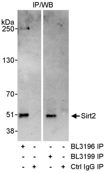 Anti-Sirt2