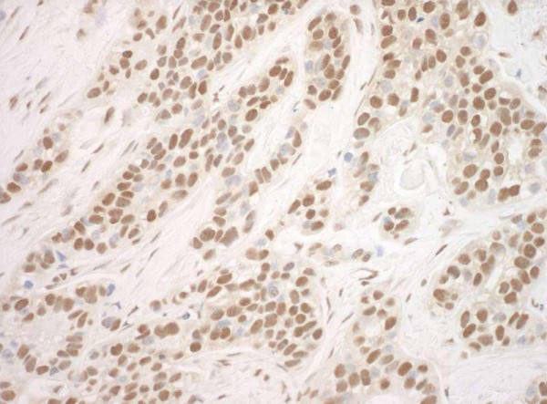 Anti-POGZ (IHC)