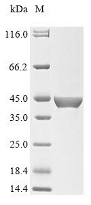 Follicle-stimulating hormone receptor (FSHR), partial, human, recombinant