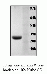 Annexin V, Recombinant