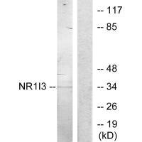 Anti-NR1I3