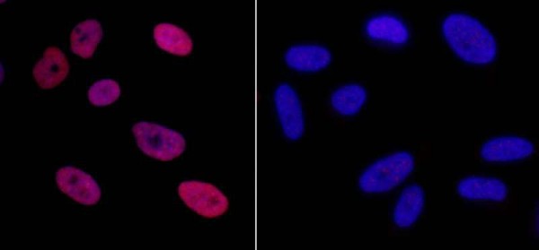 Anti-phospho-KAP-1 (Ser824) (IHC)