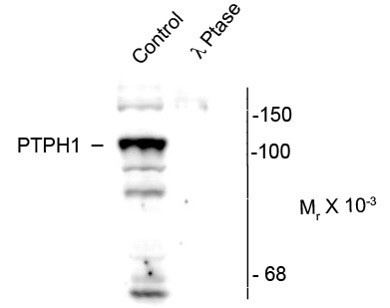 Anti-phospho-PTPN3 / PTPH1 (Ser459)