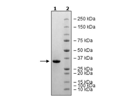 3CL Protease (T21I, A173V) (SARS-CoV-2) Recombinant