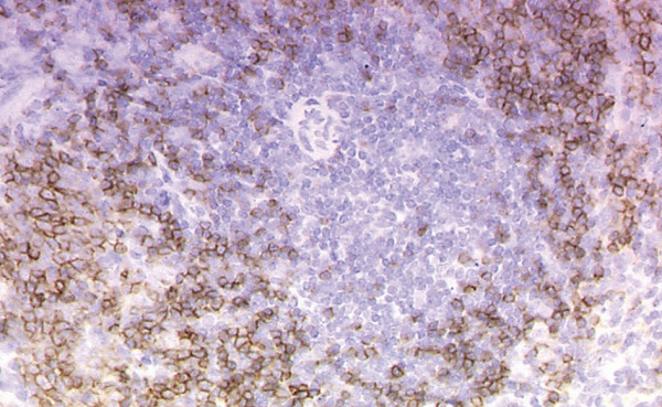 Anti-CD45R, clone RA3-6B2