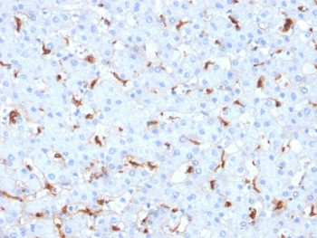Anti-C1QB / Complement C1q B-Chain, clone C1QB/2961