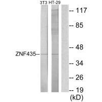 Anti-ZSCAN16
