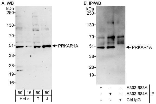 Anti-PRKAR1A